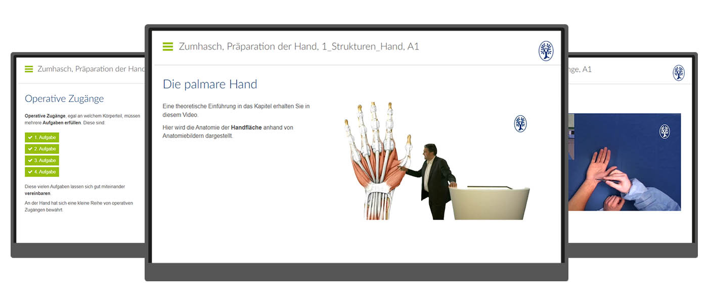 Präparation der Hand
